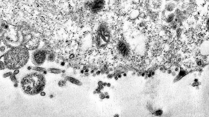 Сделаны фото атаки клеток COVID-19 под микроскопом