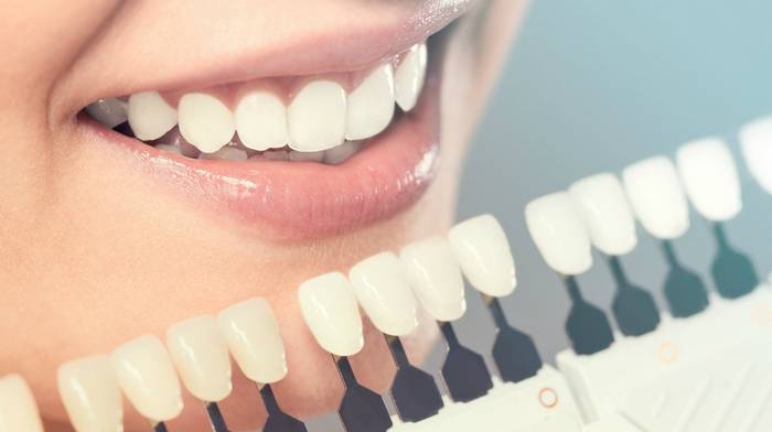 Отбеливание зубов в стоматологии: почему меняется цвет зубов и кто поможет это исправить