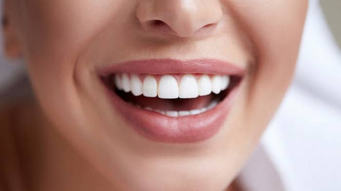 Отбеливание зубов в стоматологии: почему меняется цвет зубов и кто пом