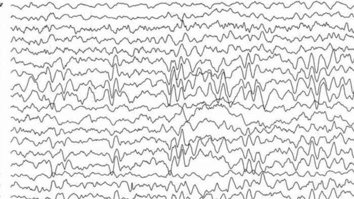 Полиция Дубая раскрыла преступление с помощью электрической активности мозга преступника