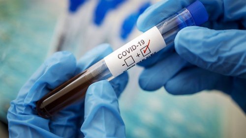 В США коронавирус уже был в пяти штатах, прежде чем власти сообщили о первых случаях заражения — исследование