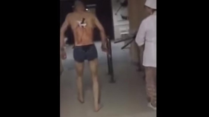 В больнице пациент с ножом в спине пошел покурить (видео)
