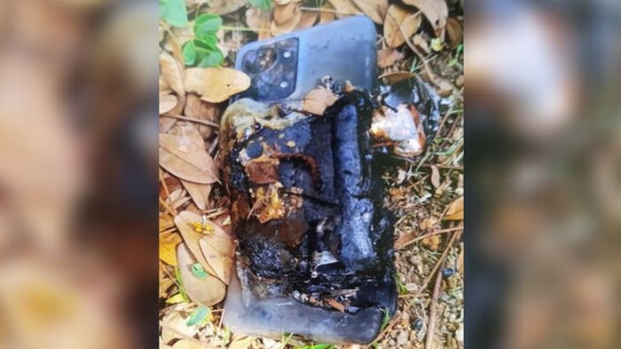 OnePlus Nord 2T взорвался в кармане у парня. Он попал в больницу