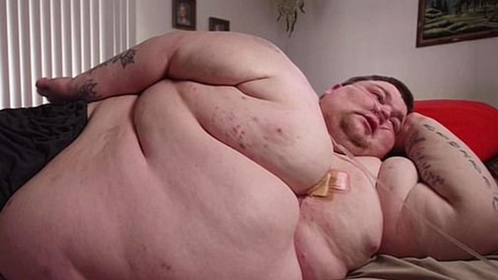 Испугавшийся смерти американец похудел на 188 кг (фото)