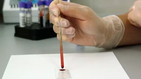 Ученые обнаружили уникальную группу крови, которая существует только у одного человека