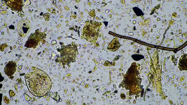 Понимание клеточной жизни под сомнением: один паразит стер грань между клеткой и вирусом