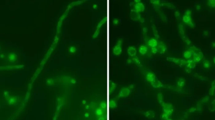 Вирус «русской матрешки« нашли внутри смертельно опасного грибка: он нацелен на людей