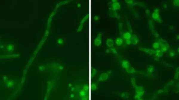 Вирус «русской матрешки« нашли внутри смертельно опасного грибка: он нацелен на людей