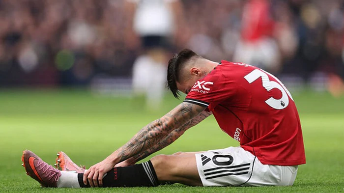 Травмированный Шешко пропустит матчи МЮ и сборной