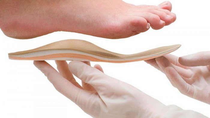 Ортопедические стельки — эффективная коррекция стопы