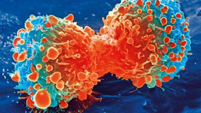 Найден способ заставить клетки организма уничтожать рак