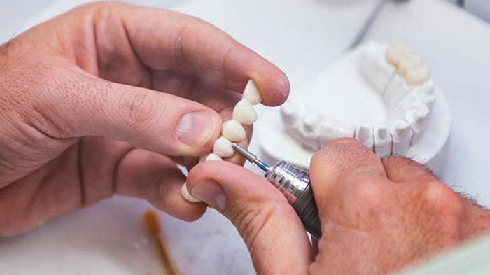 Назначение и особенности выбора CAD/CAM системы в стоматологии