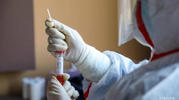 Украина получила тест-системы для диагностики коронавируса