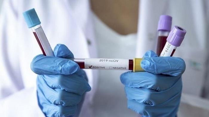 В Украину завезут тесты на коронавирус за 300 гривен